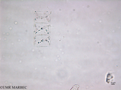 phyto/Brazilian_Amazon_coast/Amazomix_station_22/AMAZOMIX September 2021/Meuniera membranacea (St22_220909_001_ovl-4).tif(copy)_thumb.jpg